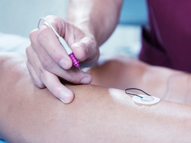 igne-emg-ile-sinir-iletim-calismasi-arasindaki-fark-nedir